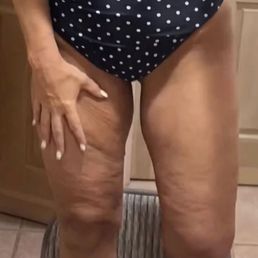 BEFORE - thighs