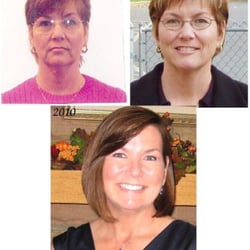 Reclaimed Beauty - Laser resurface "erbium" before and afters