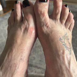 Pedi