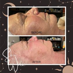 Skin by Wren