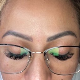 This is what my eye brows look like about two years later. One is higher than the other and different shapes. This is what my eye brows look like about two years later. One is higher than the other and different shapes.