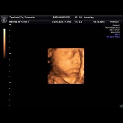 Annerley The Midwives Clinic - 4D ultrasounds of my baby