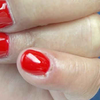 Sienna Nails & Spa - Beat up cuticles. - Nail Salons Near Me - Phoenix, Arizona Sienna Nails & Spa - Beat up cuticles. - Nail Salons Near Me - Phoenix, Arizona
