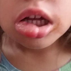 Central Coast Pediatric Dental Group