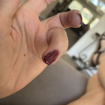 First Nails - Globs of gel left on sides where it bubbled - Nail Salons Near Me - Lakeport, California First Nails - Globs of gel left on sides where it bubbled - Nail Salons Near Me - Lakeport, California