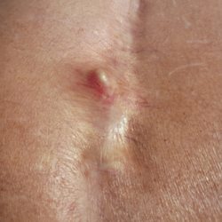Axis Pain Center