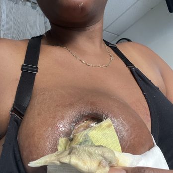 Professional Plastic Surgery - My breast has dead tissue because he didn't do my surgery right he's such a sorry poor excuse for a doctor - Cosmetic Surgeons Near Me - Miami, Florida