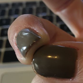 On LA Nails - Jagged and raw cuticles. - Nail Salons Near Me - Los Angeles, California On LA Nails - Jagged and raw cuticles. - Nail Salons Near Me - Los Angeles, California