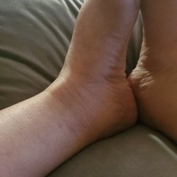 Johnson C, MD - These would be my feet for 8 months now