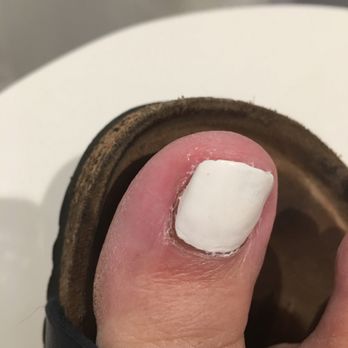 Hello Nails & Spa - Very red and swollen - Day Spas Near Me - Vacaville, California Hello Nails & Spa - Very red and swollen - Day Spas Near Me - Vacaville, California
