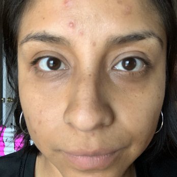 Skin Deep By Victoria - April 2019 - Skin Care Near Me - Goodyear, Arizona Skin Deep By Victoria - April 2019 - Skin Care Near Me - Goodyear, Arizona