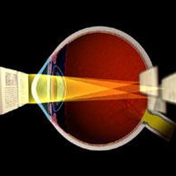 Eye Clinic Of Racine