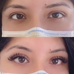 Before and after