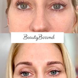 Beautybossmd Academy - Before and after microblading