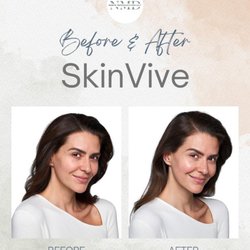 North Metro Dermatology