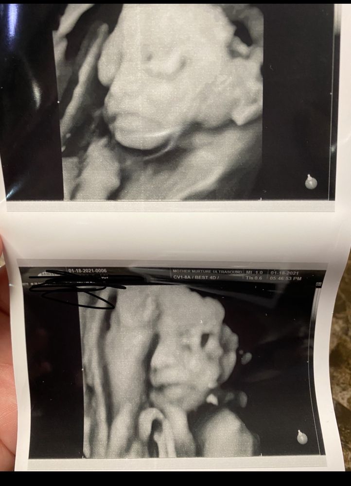 MOTHER NURTURE 3D/4D ULTRASOUND STUDIO 41 Photos & 32 Reviews 803