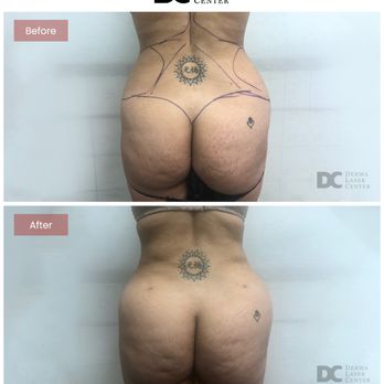 Derma Laser Centers - Medical Spas Near Me - Mercerville, New Jersey Derma Laser Centers - Medical Spas Near Me - Mercerville, New Jersey