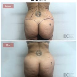 Derma Laser Centers