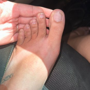 Lovely Nails - Lots of dead skin, and my toenails are not squared off as I asked. Very crooked. - Nail Salons Near Me - Saint Petersburg, Florida Lovely Nails - Lots of dead skin, and my toenails are not squared off as I asked. Very crooked. - Nail Salons Near Me - Saint Petersburg, Florida