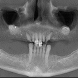 Chesapeake Oral Surgery Associates - Oral surgery Severna Park, MD