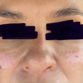 Jovem Medspa - Medical Spas Near Me - San Antonio, Texas Jovem Medspa - Medical Spas Near Me - San Antonio, Texas