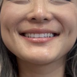 Hailey's IBeauty - 5 weeks healed lip blush