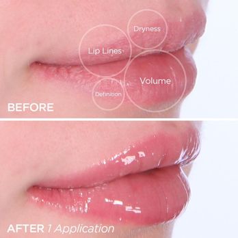 Klovers Lip Lab - Permanent Makeup Near Me - Los Angeles, California Klovers Lip Lab - Permanent Makeup Near Me - Los Angeles, California