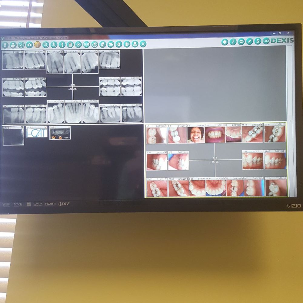 Runion Dental Group at Mill Run - Hope my dental records don't scare u (they shouldn't) the dentist came & spoke to me (WO THE JARGON) on this hi-tech tv ISAW EVERYTHING - General Dentistry Near Me - Hilliard, Ohio Runion Dental Group at Mill Run - Hope my dental records don't scare u (they shouldn't) the dentist came & spoke to me (WO THE JARGON) on this hi-tech tv ISAW EVERYTHING - General Dentistry Near Me - Hilliard, Ohio