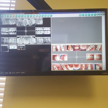 Runion Dental Group at Mill Run - Hope my dental records don't scare u (they shouldn't)   the dentist came & spoke to me (WO THE JARGON) on this hi-tech tv ISAW EVERYTHING - General Dentistry Near Me - Hilliard, Ohio