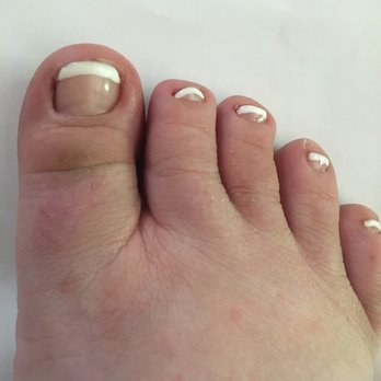Best City Nails - A callous on top of my toe still and the widest most unprofessional looking paint job ever. Do you see the paint still all over!?!? - Nail Salons Near Me - Wausau, Wisconsin