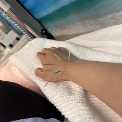 Acupuncture Thousand Branches