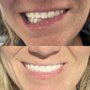 Photo of Tahoe Injectables