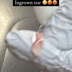 Utley John D DPM - What was in my skin *toenail