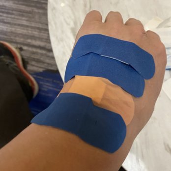 Lancaster Marriott at Penn Square - Bandaged hand - Hotels Near Me - Lancaster, Pennsylvania
