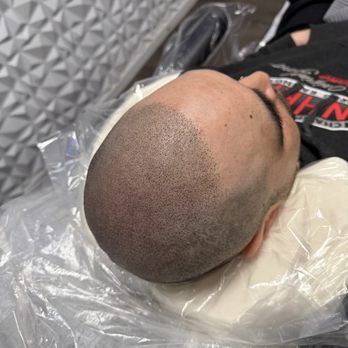 Scalp Micropigmentation Academy - Final smp results - Hair Loss Centers Near Me - San Lorenzo, California Scalp Micropigmentation Academy - Final smp results - Hair Loss Centers Near Me - San Lorenzo, California