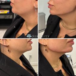Serenity MedSpa