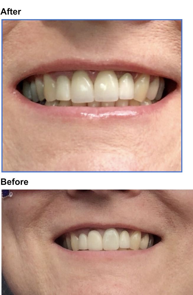 POST FALLS FAMILY DENTAL CENTER 11 Photos & 17 Reviews 313 N