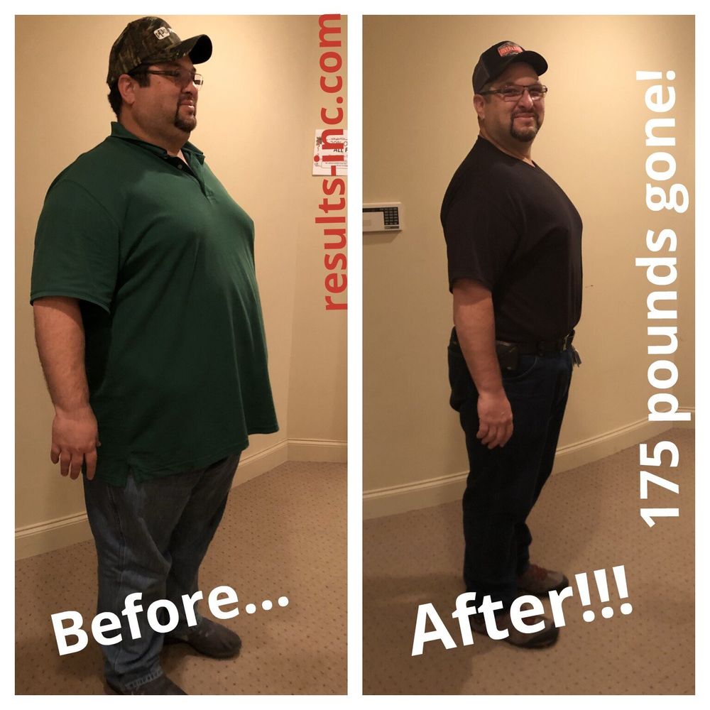 RESULTS WEIGHT LOSS CENTERS CANTON Updated September 2024 37