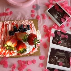 Mommys Miracle Ultrasound - Perfect ultrasound