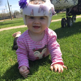 تأخر علاج الرأس المسطح بالخوذة