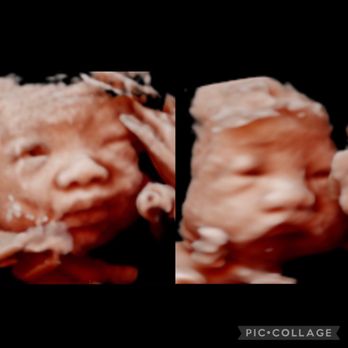 Oh Baby - Lauren caught her opening her eyes! - Diagnostic Imaging Near Me - Rancho Cucamonga, California