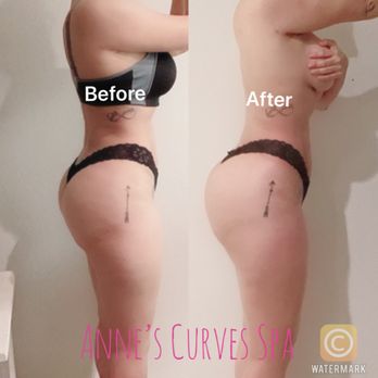 Anne's Curves - Wood therapy - Skin Care Near Me - Corona, California