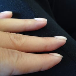 Taken the next morning. She didn't get very close to the cuticle. -_- Taken the next morning. She didn't get very close to the cuticle. -_-