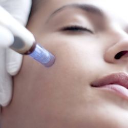 Laserderm MedSpa - Skin Treatments: Microneedle, RF Skin Tightening, Microderm, Custom Facials and Photofacials