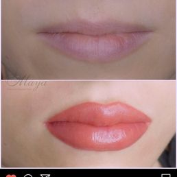 Before and after