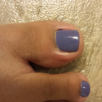 Lavender Nail Spa - See the swollen right side of ky big toe?? - Nail Salons Near Me - Vacaville, California Lavender Nail Spa - See the swollen right side of ky big toe?? - Nail Salons Near Me - Vacaville, California