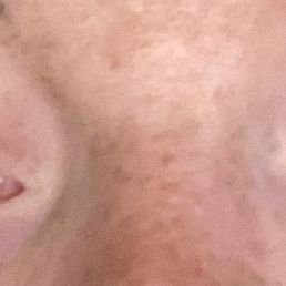 Right after permanent eyeliner Right after permanent eyeliner