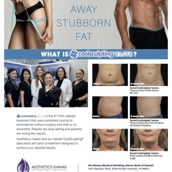Aesthetics Hawaii - CoolSculpting Elite