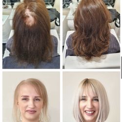 Salon Republic - Hair replacement via Hair Dreams