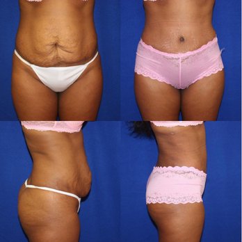 Mesbahi Plastic Surgery - Cosmetic Surgeons Near Me - McLean, Virginia